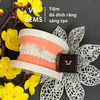 Đá đính răng cánh bướm hình thoi (Tặng kèm keo bút khi mua bộ đá)