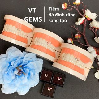 Đá đính răng cánh bướm hình thoi (Tặng kèm keo bút khi mua bộ đá)
