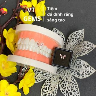 Đá đính răng cánh bướm hình thoi (Tặng kèm keo bút khi mua bộ đá)