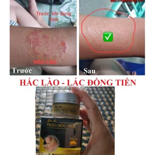 [ CHÍNH HÃNG ] KEM BÔI DA THẢO MỘC NAM