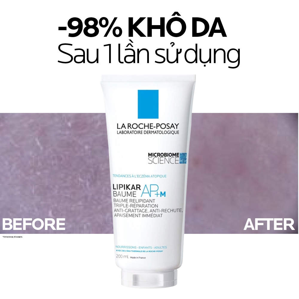 Kem dưỡng làm dịu da cho da khô và ngứa La Roche Posay Lipikar Baume AP+M 200ml