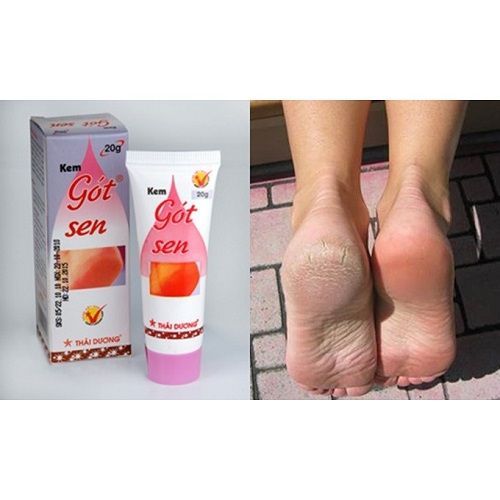 Kem Gót Sen dưỡng ẩm, chống nứt nẻ chân tay Sao Thái Dương 20g