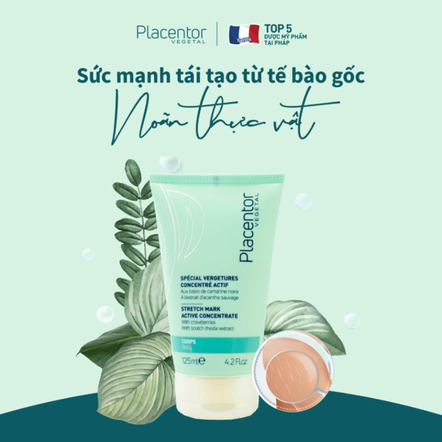 Kem dưỡng rạn da Placentor Stretch Marks Active Concentrate 125ml