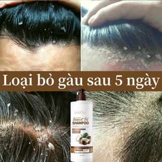 Dầu gội dừa dầu gội gàu dầu gội nấm da đầu 500ml dầu gội xả dưỡng tóc dầu gội cho tóc dầu bết hết ngứa da đầu