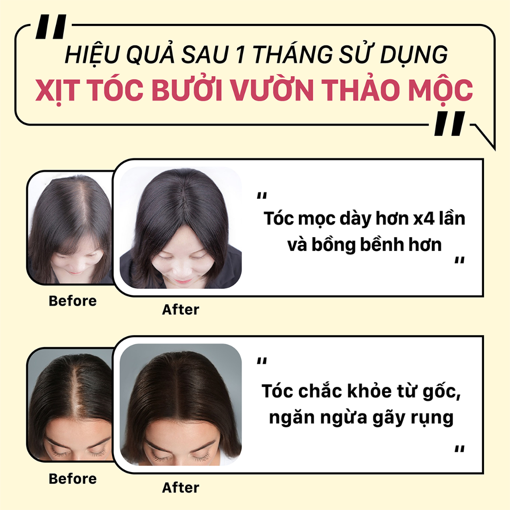 Combo cao cấp 3 sản phẩm Phục Hồi Mọc tóc Mềm Mượt Chắc Khỏe VƯỜN THẢO MỘC