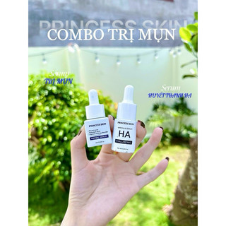 Serum mụn princess và serum huyết thanh mẫu mới