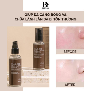Tinh chất dưỡng da Benton Snail Bee High Content Essence 100ml