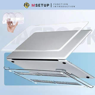 Case Macbook, Ốp Macbook Trong Suốt (TẶNG NÚT CHỐNG BỤI, KẸP CHỐNG GẪY SẠC)