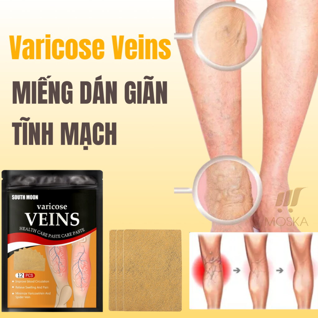 Miếng Dán Giãn Tĩnh Mạch South Moon - Làm Bền Thành Mạch, Giảm Sưng, Phù Nề, Tăng Cường Lưu Thông Máu Hộp 12 miếng|Moska