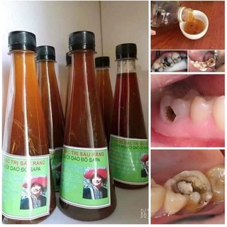 Nước súc miệng sâu răng người Dao đỏ