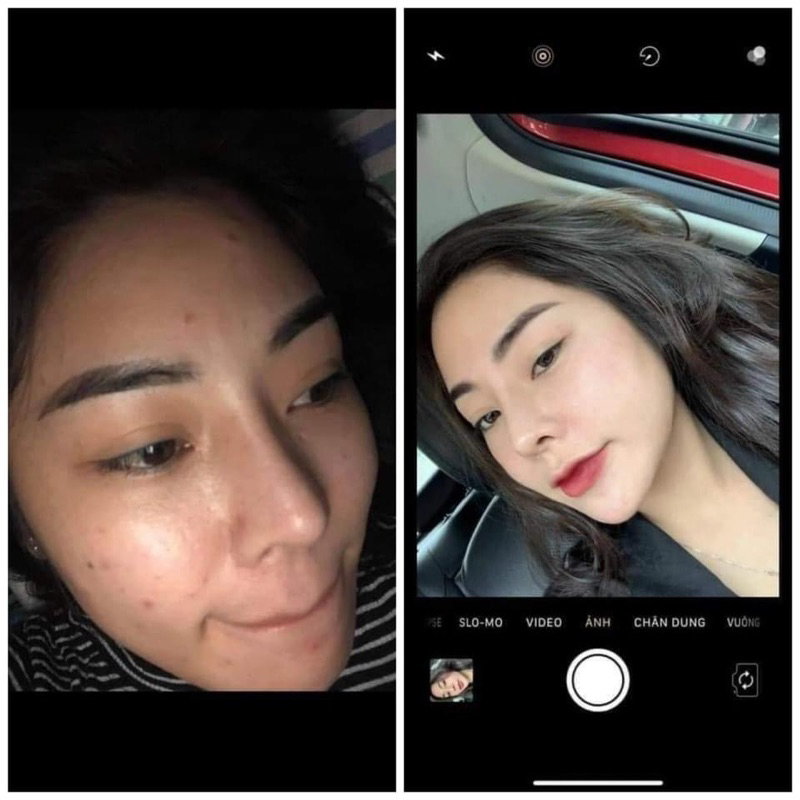 TÁI TẠO HỒNG SÂM