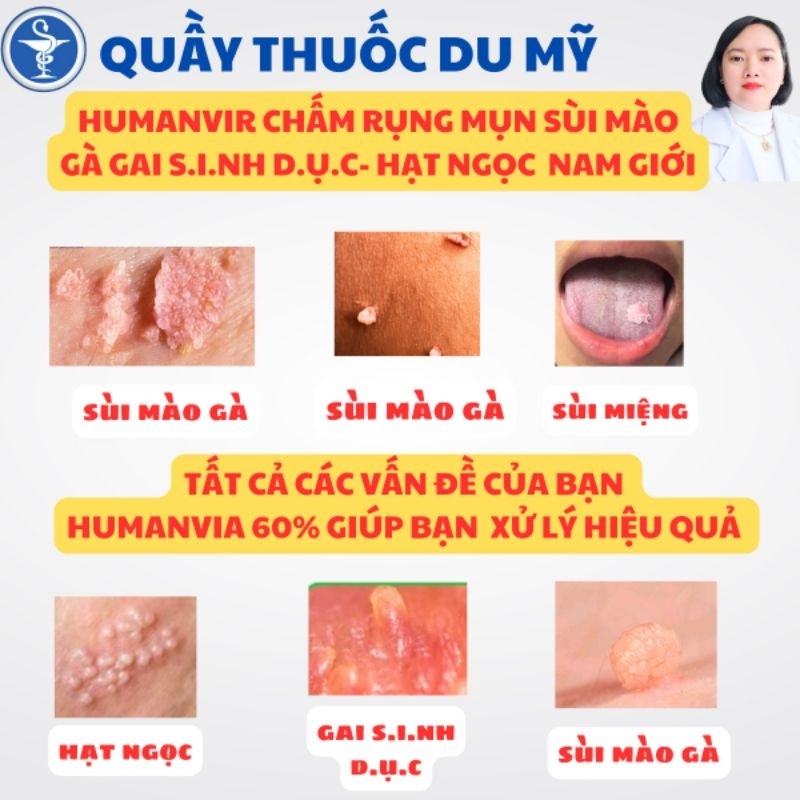Humanvia ATC 60% thổi bay sùi mào gà mụn cóc mụn gai sd hạt ngọc Quầy thuốc Du Mỹ