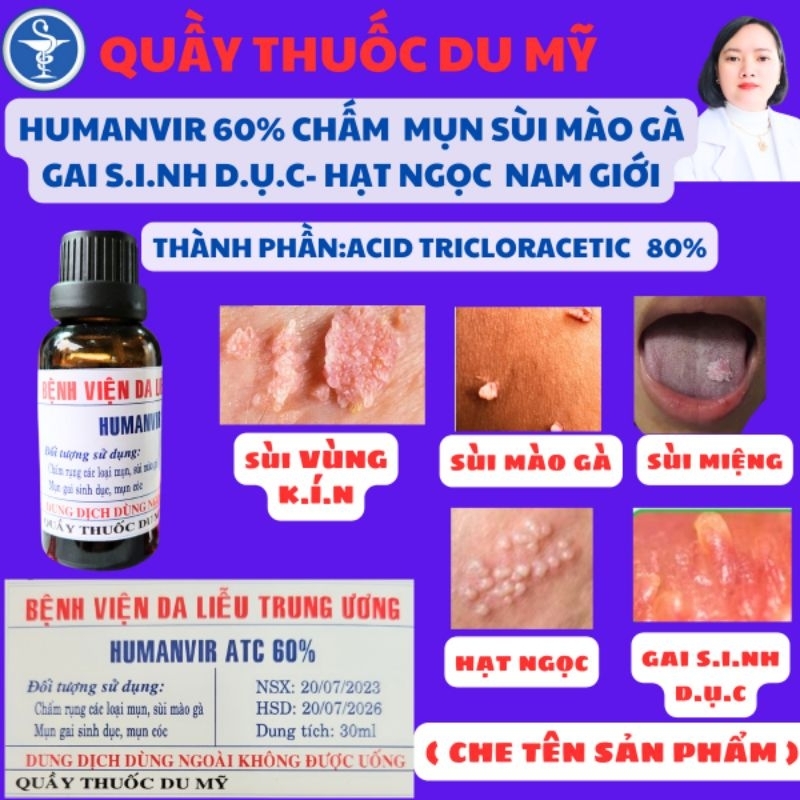 Humanvia ATC 60% thổi bay sùi mào gà mụn cóc mụn gai sd hạt ngọc Quầy thuốc Du Mỹ