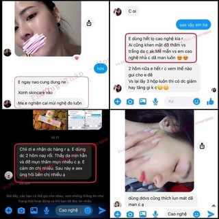 Cao tinh nghệ 70gr chăm sóc da mụn thâm nám tàn nhang | vũ phương thảo mom shin | shop mẹ thảo | mẹ shin