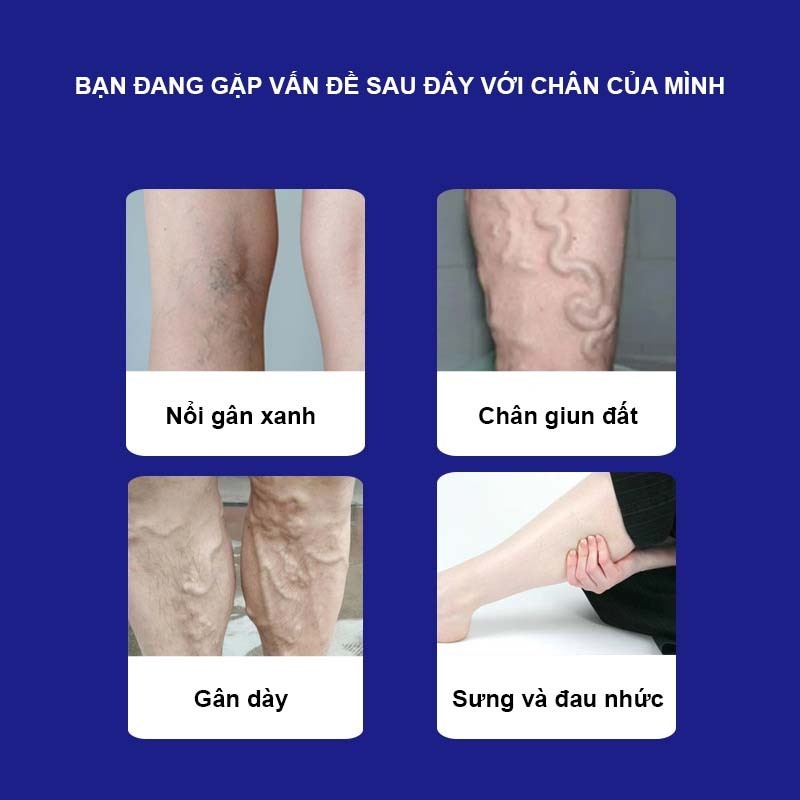 Kem Giãn Tĩnh Mạch Senjoko Nhật Bản 50g - Kem Senjoko Hỗ Trợ Tuần Hoàn Mao Mạch, Chăm Sóc Tĩnh Mạch Hiệu Quả