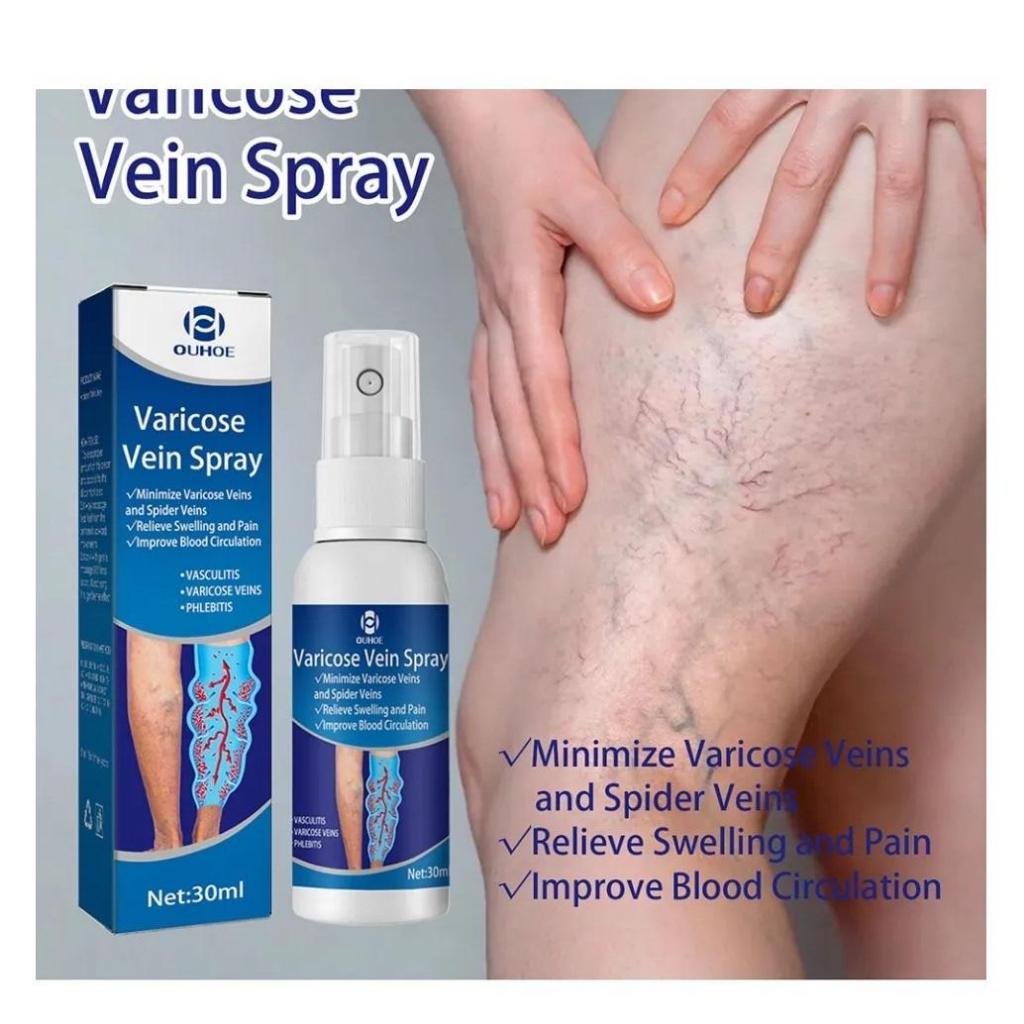 Tinh Chất Thảo Dược Suy Giãn Tĩnh Mạch Varicose Vein Spray 30ml - Xịt Cải Thiện Lưu Thông Hết Suy Giãn Tĩnh Mạch
