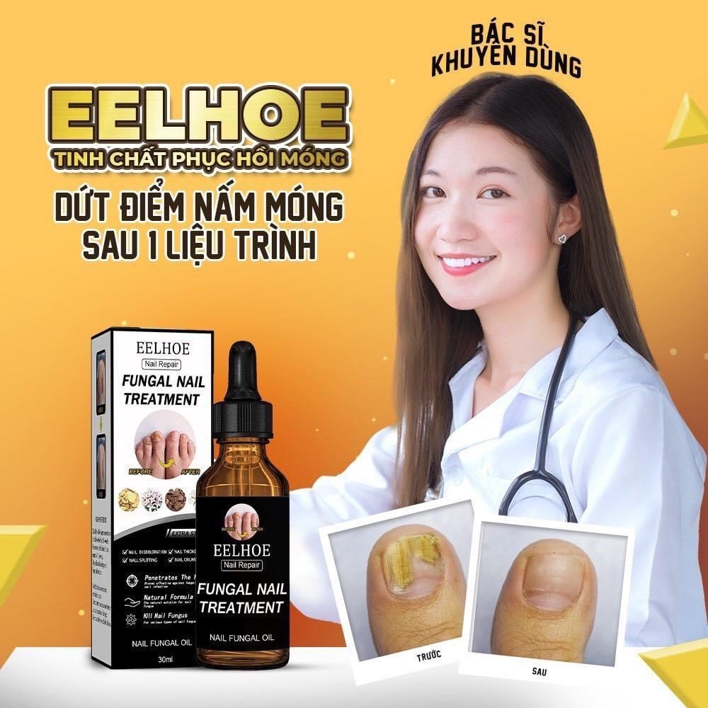 Serum Nấm Móng Thảo Dược Eelhoe Hoa Kì - Tinh Chất Dưỡng Móng Phục Hồi Mô Móng Eelhoe