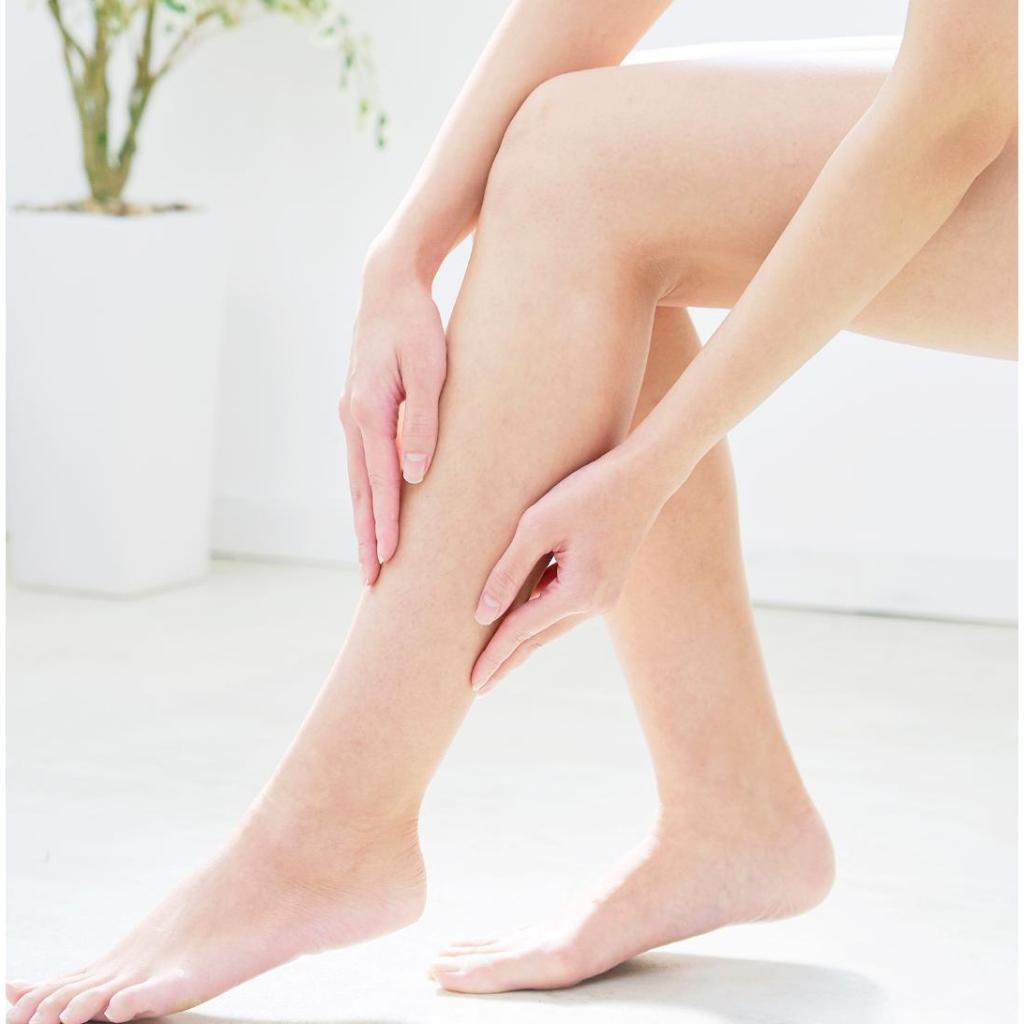 Kem Thảo Dược Varicose Veins Cream - Kem Bôi Cải Thiện Suy Giãn Tĩnh Mạch Làm Dịu Hỗ Trợ Lưu Thông Mao Mạch