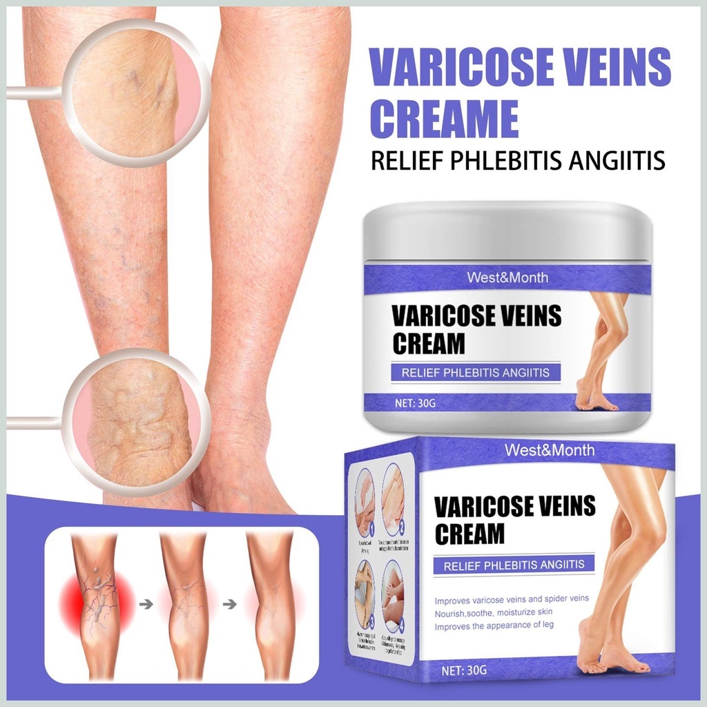 Kem Thảo Dược Varicose Veins Cream - Kem Bôi Cải Thiện Suy Giãn Tĩnh Mạch Làm Dịu Hỗ Trợ Lưu Thông Mao Mạch