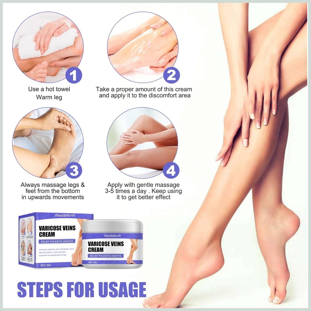 Kem Thảo Dược Varicose Veins Cream - Kem Bôi Cải Thiện Suy Giãn Tĩnh Mạch Làm Dịu Hỗ Trợ Lưu Thông Mao Mạch