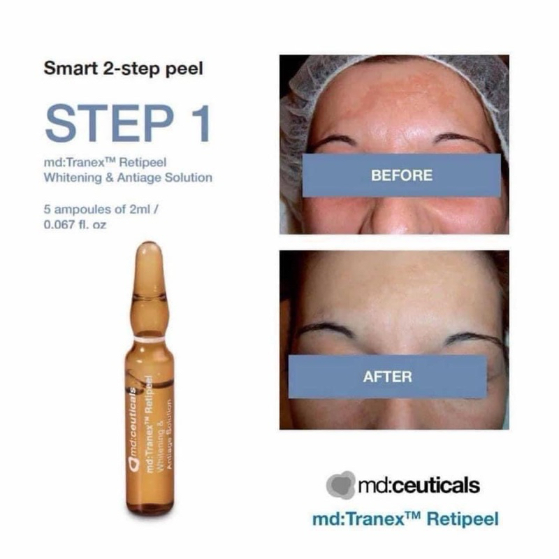 MD:CEUTICALS MD: TRANEX RETIPEE – PEEL 5 ống x 5 mặt nạ