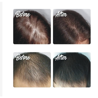 Tinh dầu bưởi xịt kích thích mọc tóc thái lan