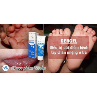 Gel làm sạch, sát khuẩn da Gergel