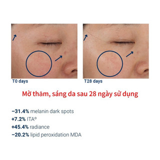 𝐊𝐞𝐦 𝐜𝐡𝐨̂́𝐧𝐠 𝐧𝐚̆́𝐧𝐠 𝐒𝐢𝐧𝐠𝐮𝐥𝐚𝐝𝐞𝐫𝐦 𝐗𝐏𝐄𝐑𝐓𝐒𝐔𝐍 𝐔𝐫𝐛𝐚𝐧 𝐒𝐏𝐅 𝟓𝟎+ 𝟓𝟎 𝐦𝐥
