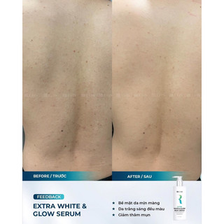 [RUCOS] KEM DƯỠNG TRẮNG BODY - EXTRA WHITE & GLOW) date 21/09/2025