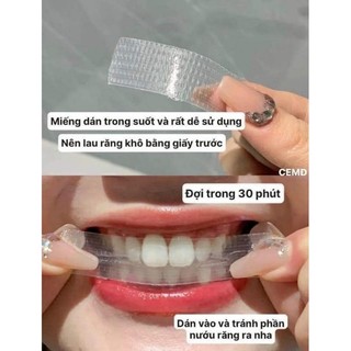 Miếng dán trắng răng Crest 3D
