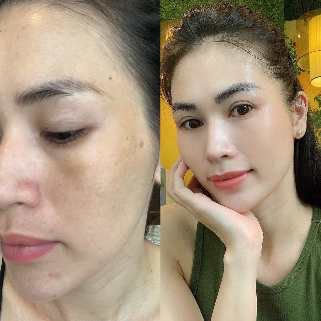 Hộp Trắng - Viên Uống Trắng Da Giảm Nám Hạn Chế Tàn Nhang Transino Viên Nhật Bản [Date 2026]