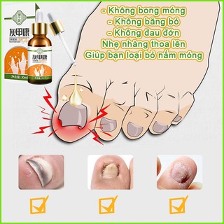 Dung dịch loại bỏ nấm móng Nấm móng Serum nấm móng dung dịch mọc móng 30ml nấm móng kích thích mọc móng nhanh chóng