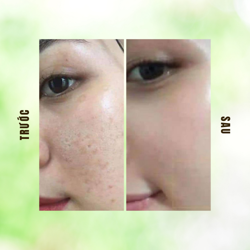 Tinh Chất Dưỡng Da Sắc Mộc Thiên - Tái Tạo Da, Se Khít Lỗ Chân Lông, Sáng Da| Moska Shop