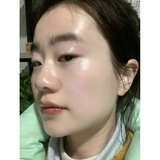 Tinh Chất Serum VitaminC 561 Esthemax