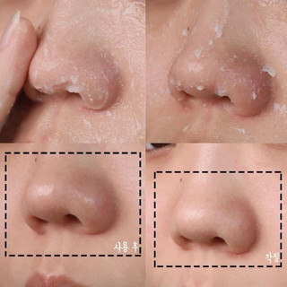 TẨY DA CHẾT mặt sáng da OHUI 100ml