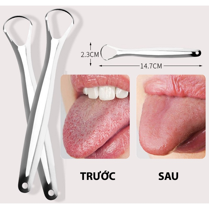 COMBO5 Dụng Cụ Cạo Lưỡi - Dụng Cụ Vệ Sinh Lưỡi Inox Giúp Loại Bỏ Vi Khuẩn Giảm Hôi Miệng Tăng Vị Giác 88456