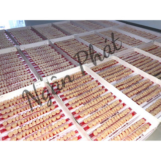 Răng nhựa Việt Nam lên răng hàm tháo lắp