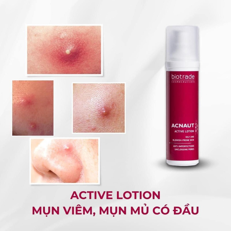 Chấm Mụn Hoạt Tính Biotrade Acnaut Active Lotion CREAM 10ml