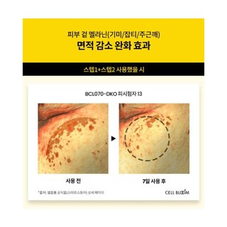 Serum tế bào gốc 2in1 Cell Bloom