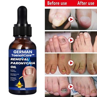 Dưỡng Cứng móng chẻ, Essence cứng móng, phục hồi móng hư tổn Yếu, Mỏng, Chẻ, Nấm Móng