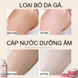 Lotion ANH - Phục Hồi Khoẻ Da