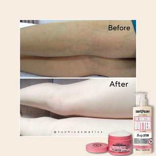 Lotion ANH - Phục Hồi Khoẻ Da