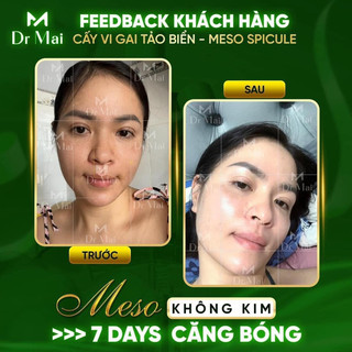 Meso căng bóng Dr Mai sale ( giá gốc 480k)