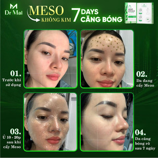 Meso căng bóng Dr Mai sale ( giá gốc 480k)