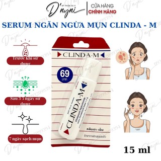 Serum Chấm Loại Bỏ Mụn CLINDA-M 15ml - Thái Lan