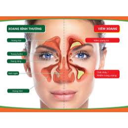 Viên uống Chikunain Kobayashi giúp hỗ trợ giảm xoang mũi chảy nước mũi ngứa mũi dị ứng Nhật Bản