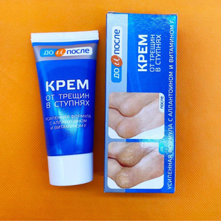 Kem Trị Nứt Gót Chân Kpem Apteka Của Nga 50ml