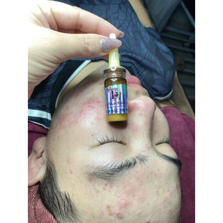 Serum dac tri mụn | khang sinh mụn | Sạch mụn khỏe da