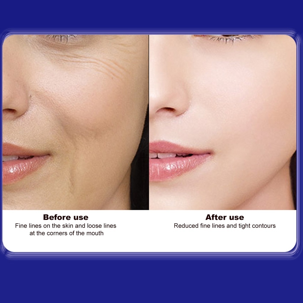 Kem Giảm Nám, Chống Nhăn Và Trẻ Hóa Da UCM Nhật Bản , Săn Chắc Và Chăm Sóc Da Chống Lão Hóa - Kem Nám Nhật | BigBuy360 - bigbuy360.vn