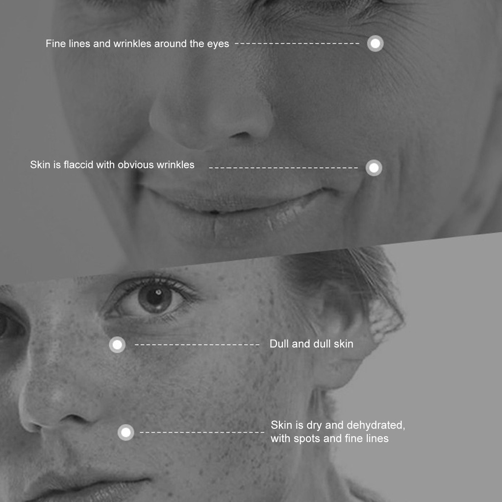 Kem Giảm Nám, Chống Nhăn Và Trẻ Hóa Da UCM Nhật Bản , Săn Chắc Và Chăm Sóc Da Chống Lão Hóa - Kem Nám Nhật | BigBuy360 - bigbuy360.vn